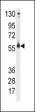 CYP2C9 / Cytochrome P450 2C9 Antibody - Western blot of anti-CYP2C9 Antibody in CEM cell line lysates (35 ug/lane). CYP2C9(arrow) was detected using the purified antibody.