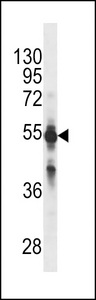 CYP2C9 / Cytochrome P450 2C9 Antibody - CYP2C9 Antibody (Ascites)western blot of NCI-H460 cell line lysates (35 ug/lane). The CYP2C9 antibody detected the CYP2C9 protein (arrow).