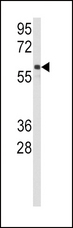 CYP2C9 / Cytochrome P450 2C9 Antibody - Western blot of anti-CYP2C9 Antibody in Jurkat cell line lysates (35 ug/lane). CYP2C9(arrow) was detected using the purified antibody.