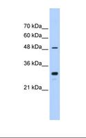 CYP2C9 / Cytochrome P450 2C9 Antibody - Jurkat cell lysate. Antibody concentration: 0.25 ug/ml. Gel concentration: 12%.  This image was taken for the unconjugated form of this product. Other forms have not been tested.