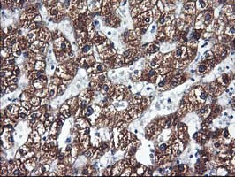 CYP2C9 / Cytochrome P450 2C9 Antibody - IHC of paraffin-embedded Human liver tissue using anti-CYP2C9 mouse monoclonal antibody.