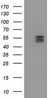 CYP2C9 / Cytochrome P450 2C9 Antibody - HEK293T cells were transfected with the pCMV6-ENTRY control (Left lane) or pCMV6-ENTRY CYP2C9 (Right lane) cDNA for 48 hrs and lysed. Equivalent amounts of cell lysates (5 ug per lane) were separated by SDS-PAGE and immunoblotted with anti-CYP2C9.