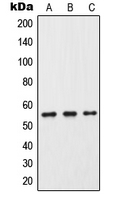 CYP2C9 / Cytochrome P450 2C9 Antibody - Western blot analysis of Cytochrome P450 2C9 expression in HeLa (A); Raw264.7 (B); PC12 (C) whole cell lysates.