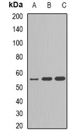 CYP2C9 / Cytochrome P450 2C9 Antibody - Western blot analysis of Cytochrome P450 2C9 expression in A549 (A); MCF7 (B); HepG2 (C) whole cell lysates.