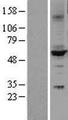 CYP2C9 / Cytochrome P450 2C9 Protein - Western validation with an anti-DDK antibody * L: Control HEK293 lysate R: Over-expression lysate