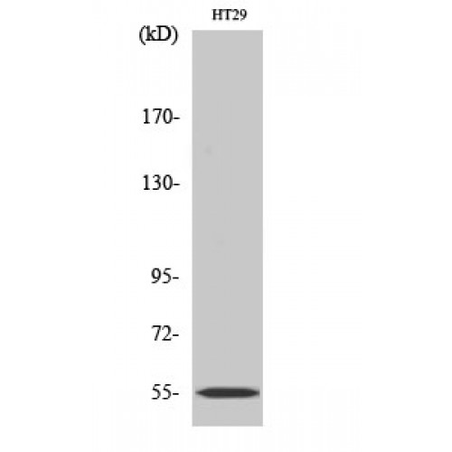 CYP2D6 Antibody - Western blot of CYP2D6 antibody