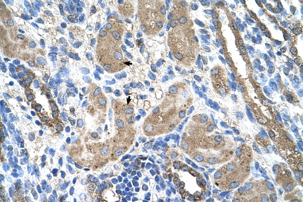 CYP2D6 Antibody - CYP2D6 antibody ARP41675_T100-NP_000097-CYP2D6(cytochrome P450, family 2, subfamily D, polypeptide 6) Antibody IHC of formalin-fixed, paraffin-embedded human Kidney. Positive label: Epithelial cells of renal tubule indicated with arrows. Antibody concentration 4-8 ug/ml. Magnification 400X.  This image was taken for the unconjugated form of this product. Other forms have not been tested.