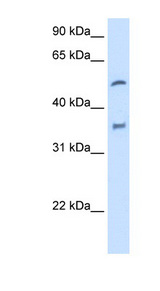 CYP2D6 Antibody - CYP2D6 antibody ARP41675_T100-NP_000097-CYP2D6(cytochrome P450, family 2, subfamily D, polypeptide 6) Antibody Western blot of Fetal Liver lysate.  This image was taken for the unconjugated form of this product. Other forms have not been tested.