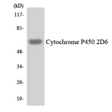 CYP2D6 Antibody - Western blot analysis of the lysates from COLO205 cells using Cytochrome P450 2D6 antibody.