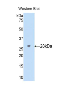 CYP2D6 Antibody - Western blot of recombinant CYP2D6.  This image was taken for the unconjugated form of this product. Other forms have not been tested.