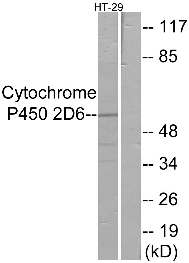 CYP2D6 Antibody - Western blot analysis of lysates from HT-29 cells, using Cytochrome P450 2D6 Antibody. The lane on the right is blocked with the synthesized peptide.