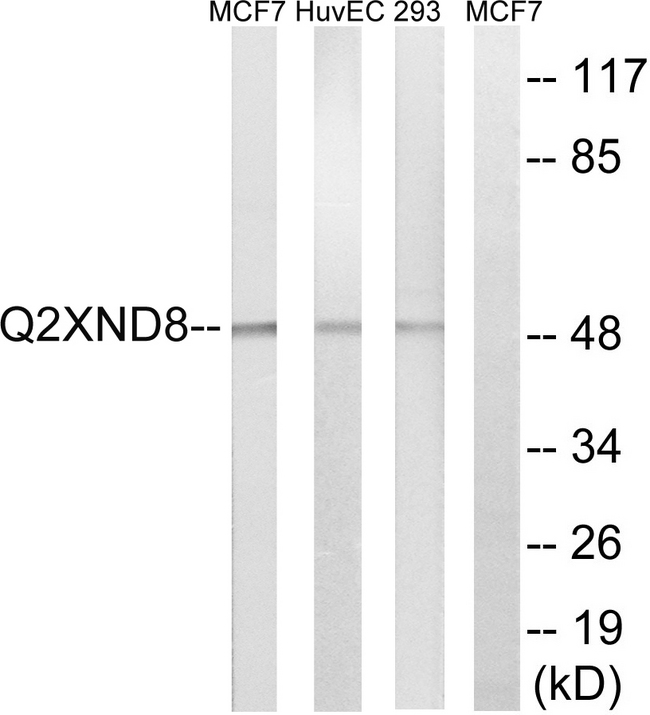 CYP2D6 Antibody - Western blot analysis of lysates from 293, HUVEC, and MCF-7 cells, using Cytochrome P450 2D6 Antibody. The lane on the right is blocked with the synthesized peptide.