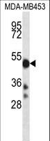 CYP2D6 Antibody - CYP2D6 Antibody western blot of MDA-MB453 cell line lysates (35 ug/lane). The CYP2D6 antibody detected the CYP2D6 protein (arrow).