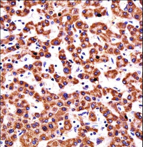 CYP2D6 Antibody - CYP2D6 Antibody immunohistochemistry of formalin-fixed and paraffin-embedded human liver tissue followed by peroxidase-conjugated secondary antibody and DAB staining.