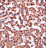 CYP2D6 Antibody - CYP2D6 Antibody immunohistochemistry of formalin-fixed and paraffin-embedded human liver tissue followed by peroxidase-conjugated secondary antibody and DAB staining.