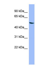CYP2D6 Antibody - CYP2D6 antibody Western blot of OVCAR-3 cell lysate. This image was taken for the unconjugated form of this product. Other forms have not been tested.