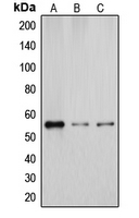 CYP2D6 Antibody - Western blot analysis of Cytochrome P450 2D6 expression in A431 (A); K562 (B); HUVEC (C) whole cell lysates.