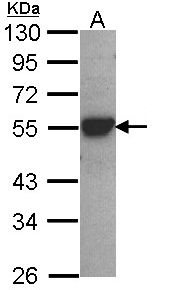 CYP2D6 Antibody - Sample (30 ug of whole cell lysate). A: A431. 7.5% SDS PAGE. CYP2D6 antibody diluted at 1:1000. 