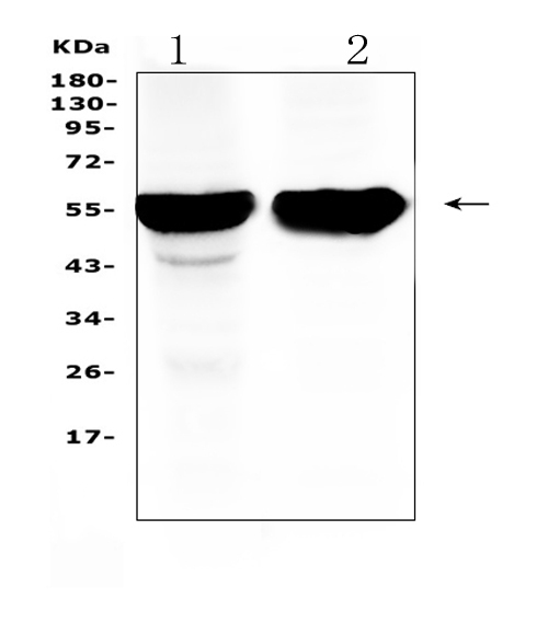 CYP2D6 Antibody - Western blot analysis of Cytochrome P450 2D6 using anti-Cytochrome P450 2D6 antibody. Electrophoresis was performed on a 5-20% SDS-PAGE gel at 70V (Stacking gel) / 90V (Resolving gel) for 2-3 hours. The sample well of each lane was loaded with 50ug of sample under reducing conditions. Lane 1: rat liver tissue lysates, Lane 2: mouse liver tissue lysates. After Electrophoresis, proteins were transferred to a Nitrocellulose membrane at 150mA for 50-90 minutes. Blocked the membrane with 5% Non-fat Milk/ TBS for 1.5 hour at RT. The membrane was incubated with rabbit anti-Cytochrome P450 2D6 antigen affinity purified polyclonal antibody at 0.5 µg/mL overnight at 4°C, then washed with TBS-0.1% Tween 3 times with 5 minutes each and probed with a goat anti-rabbit IgG-HRP secondary antibody at a dilution of 1:10000 for 1.5 hour at RT. The signal is developed using an Enhanced Chemiluminescent detection (ECL) kit with Tanon 5200 system. A specific band was detected for Cytochrome P450 2D6 at approximately 56KD. The expected band size for Cytochrome P450 2D6 is at 56KD.
