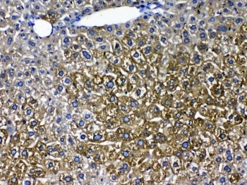 CYP2D6 Antibody - IHC testing of FFPE mouse liver tissue with CYP2D6 antibody at 1ug/ml. Required HIER: steam section in pH6 citrate buffer for 20 min and allow to cool prior to testing.