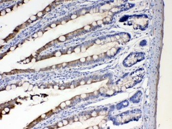 CYP2D6 Antibody - IHC testing of FFPE rat intestine tissue with CYP2D6 antibody at 1ug/ml. Required HIER: steam section in pH6 citrate buffer for 20 min and allow to cool prior to testing.
