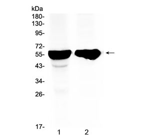 CYP2D6 Antibody - Western blot testing of 1) rat liver and 2) mouse liver tissue with CYP2D6 antibody at 0.5ug/ml. Predicted molecular weight ~56 kDa.