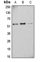 CYP2D6 Antibody - Western blot analysis of Cytochrome P450 2D6 expression in A431 (A); K562 (B); HUVEC (C) whole cell lysates.
