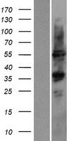 CYP2D6 Protein - Western validation with an anti-DDK antibody * L: Control HEK293 lysate R: Over-expression lysate