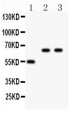 CYP2E1 Antibody - CYP2E1 antibody Western blot. All lanes: Anti CYP2E1 at 0.5 ug/ml. Lane 1: Rat Liver Tissue Lysate at 50 ug. Lane 2: HELA Whole Cell Lysate at 40 ug. Lane 3: JURKAT Whole Cell Lysate at 40 ug. Predicted band size: 55 kD. Observed band size: 65 kD.
