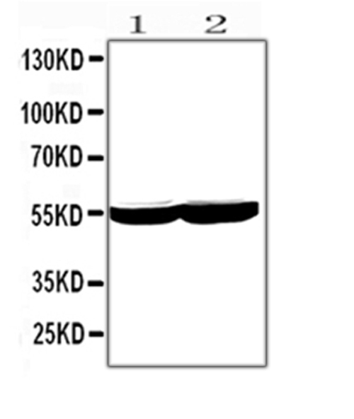 CYP2E1 Antibody - Western blot analysis of CYP2E1 using anti-CYP2E1 antibody. Electrophoresis was performed on a 5-20% SDS-PAGE gel at 70V (Stacking gel) / 90V (Resolving gel) for 2-3 hours. The sample well of each lane was loaded with 50ug of sample under reducing conditions. lane 1: rat liver tissue lysate,lane 2: mouse liver tissue lysate. After Electrophoresis, proteins were transferred to a Nitrocellulose membrane at 150mA for 50-90 minutes. Blocked the membrane with 5% Non-fat Milk/ TBS for 1.5 hour at RT. The membrane was incubated with rabbit anti-CYP2E1 antigen affinity purified polyclonal antibody at 0.5 µg/mL overnight at 4°C, then washed with TBS-0.1% Tween 3 times with 5 minutes each and probed with a goat anti-rabbit IgG-HRP secondary antibody at a dilution of 1:10000 for 1.5 hour at RT. The signal is developed using an Enhanced Chemiluminescent detection (ECL) kit with Tanon 5200 system. A specific band was detected for CYP2E1 at approximately 55KD. The expected band size for CYP2E1 is at 57KD.