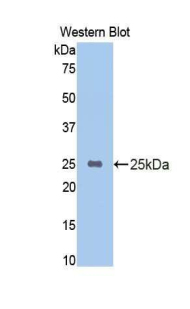 CYP2E1 Antibody - Western blot of recombinant CYP2E1.  This image was taken for the unconjugated form of this product. Other forms have not been tested.