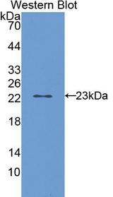 CYP2E1 Antibody - Western Blot; Sample: Recombinant protein.