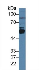CYP2E1 Antibody - Western Blot; Sample: Rat Liver lysate; Primary Ab: 3µg/ml Rabbit Anti-Rat CYP2E1 Antibody Second Ab: 0.2µg/mL HRP-Linked Caprine Anti-Rabbit IgG Polyclonal Antibody