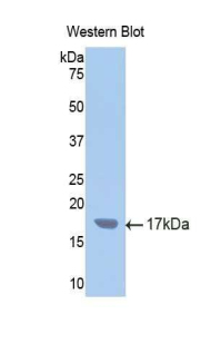 CYP2E1 Antibody - Western blot of recombinant CYP2E1.  This image was taken for the unconjugated form of this product. Other forms have not been tested.