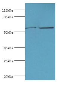 CYP2E1 Antibody - Western blot. All lanes: CYP2E1 antibody at 12 ug/ml. Lane 1: Jurkat whole cell lysate Lane 2: mouse liver tissue. Secondary antibody: goat polyclonal to rabbit at 1:10000 dilution. Predicted band size: 57 kDa. Observed band size: 57 kDa.  This image was taken for the unconjugated form of this product. Other forms have not been tested.