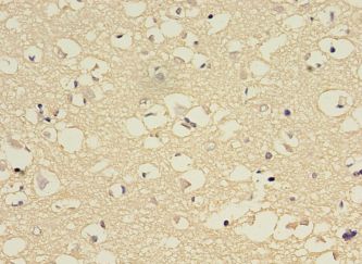 CYP2E1 Antibody - Immunohistochemistry of paraffin-embedded human brain tissue using antibody at 1:100 dilution.  This image was taken for the unconjugated form of this product. Other forms have not been tested.