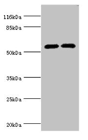 CYP2E1 Antibody - Western blot All lanes: CYP2E1 antibody at 12µg/ml Lane 1: Jurkat whole cell lysate Lane 2: Mouse liver tissue Secondary Goat polyclonal to rabbit IgG at 1/10000 dilution Predicted band size: 57 kDa Observed band size: 57 kDa