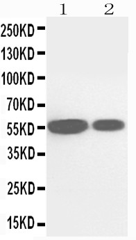 CYP2E1 Antibody - WB of CYP2E1 antibody. Lane 1: Rat Liver Tissue Lysate. Lane 2: Mouse Liver Tissue Lysate.