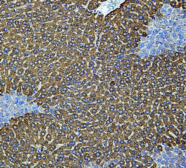 CYP2E1 Antibody - IHC analysis of CYP2E using anti-CYP2E antibody. CYP2E was detected in paraffin-embedded section of mouse liver tissue. Heat mediated antigen retrieval was performed in citrate buffer (pH6, epitope retrieval solution) for 20 mins. The tissue section was blocked with 10% goat serum. The tissue section was then incubated with 1µg/ml rabbit anti-CYP2E Antibody overnight at 4°C. Biotinylated goat anti-rabbit IgG was used as secondary antibody and incubated for 30 minutes at 37°C. The tissue section was developed using Strepavidin-Biotin-Complex (SABC) with DAB as the chromogen.