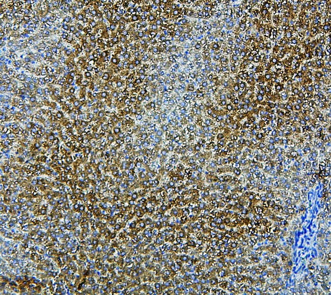 CYP2E1 Antibody - IHC analysis of CYP2E using anti-CYP2E antibody. CYP2E was detected in paraffin-embedded section of rat liver tissue. Heat mediated antigen retrieval was performed in citrate buffer (pH6, epitope retrieval solution) for 20 mins. The tissue section was blocked with 10% goat serum. The tissue section was then incubated with 1µg/ml rabbit anti-CYP2E Antibody overnight at 4°C. Biotinylated goat anti-rabbit IgG was used as secondary antibody and incubated for 30 minutes at 37°C. The tissue section was developed using Strepavidin-Biotin-Complex (SABC) with DAB as the chromogen.