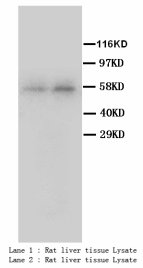 CYP2E1 Antibody -  This image was taken for the unconjugated form of this product. Other forms have not been tested.