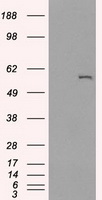 CYP2E1 Antibody - HEK293T cells were transfected with the pCMV6-ENTRY control (Left lane) or pCMV6-ENTRY CYP2E1 (Right lane) cDNA for 48 hrs and lysed. Equivalent amounts of cell lysates (5 ug per lane) were separated by SDS-PAGE and immunoblotted with anti-CYP2E1.