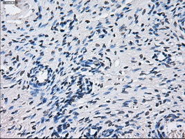 CYP2E1 Antibody - Immunohistochemical staining of paraffin-embedded Ovary tissue using anti-CYP2E1 mouse monoclonal antibody. (Dilution 1:50).