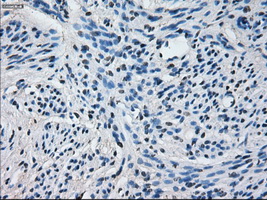 CYP2E1 Antibody - Immunohistochemical staining of paraffin-embedded endometrium tissue using anti-CYP2E1 mouse monoclonal antibody. (Dilution 1:50).