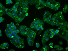CYP2E1 Antibody - Immunofluorescent staining of HepG2 cells using anti-CYP2E1 mouse monoclonal antibody.