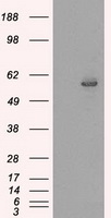 CYP2E1 Antibody - HEK293T cells were transfected with the pCMV6-ENTRY control (Left lane) or pCMV6-ENTRY CYP2E1 (Right lane) cDNA for 48 hrs and lysed. Equivalent amounts of cell lysates (5 ug per lane) were separated by SDS-PAGE and immunoblotted with anti-CYP2E1.