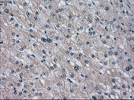 CYP2E1 Antibody - Immunohistochemical staining of paraffin-embedded liver tissue using anti-CYP2E1 mouse monoclonal antibody. (Dilution 1:50).