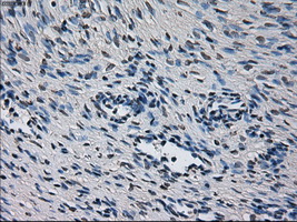 CYP2E1 Antibody - Immunohistochemical staining of paraffin-embedded Ovary tissue using anti-CYP2E1 mouse monoclonal antibody. (Dilution 1:50).