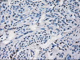 CYP2E1 Antibody - Immunohistochemical staining of paraffin-embedded endometrium tissue using anti-CYP2E1 mouse monoclonal antibody. (Dilution 1:50).