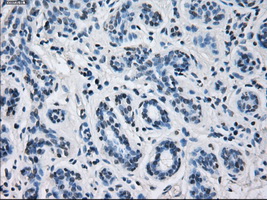 CYP2E1 Antibody - Immunohistochemical staining of paraffin-embedded breast tissue using anti-CYP2E1 mouse monoclonal antibody. (Dilution 1:50).